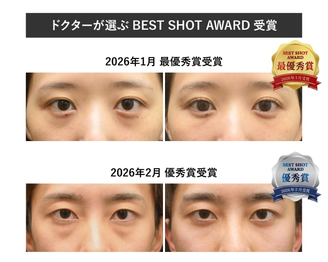 ベストショットアワード受賞医による診断