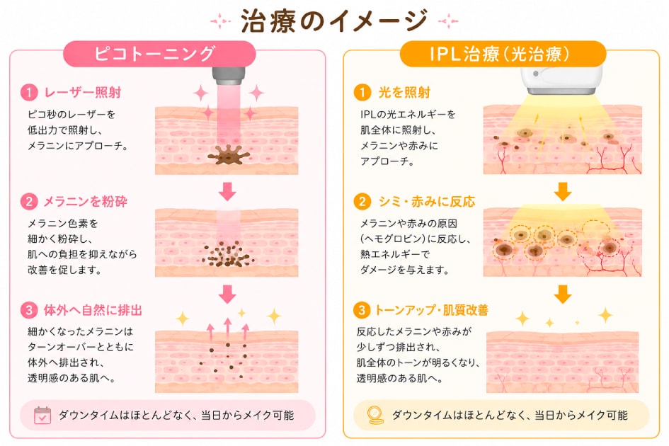 治療のメカニズムとダウンタイムの違い