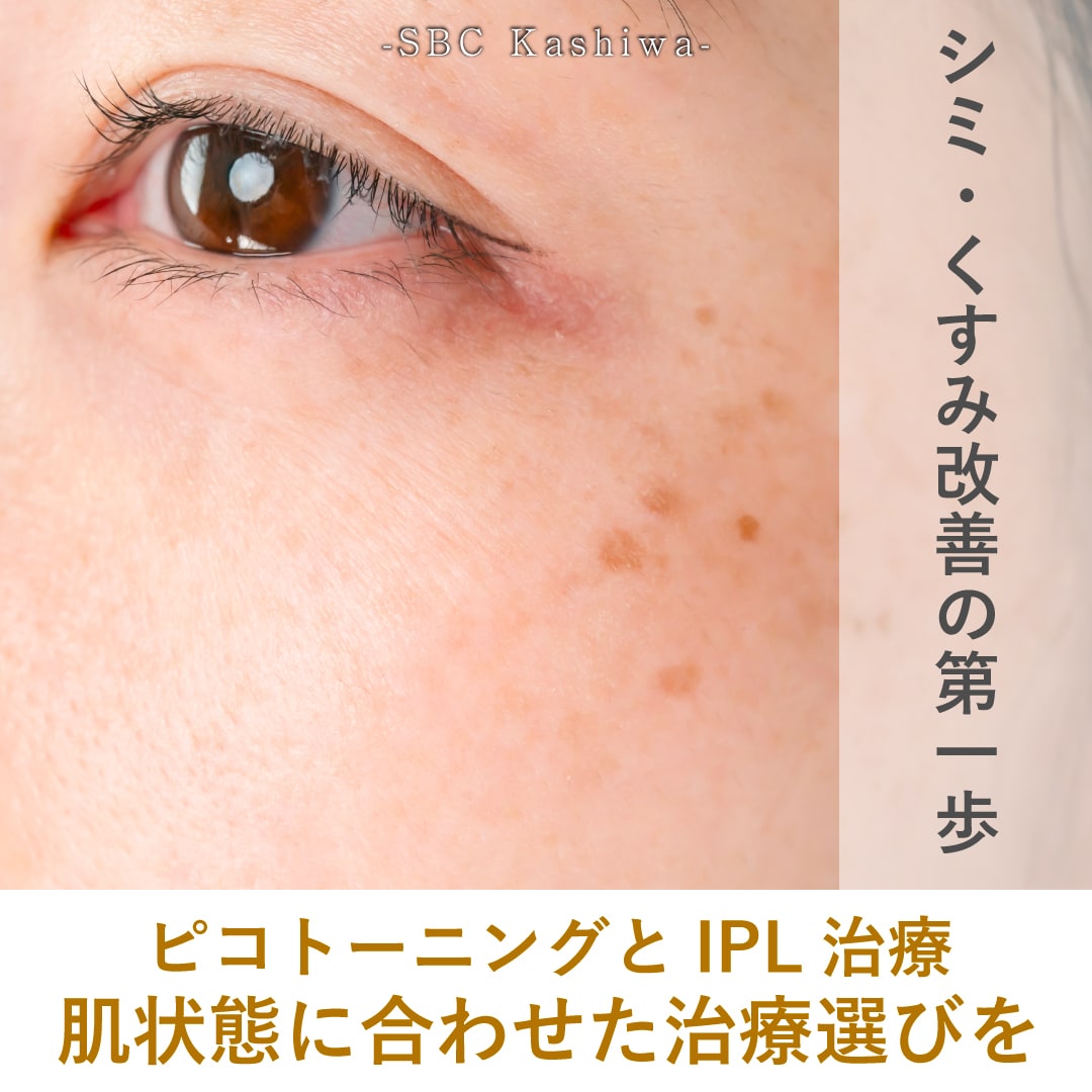 柏でシミ・くすみ治療ならどっち？ピコトーニングとIPL（光治療）の違いを上田院長が解説！