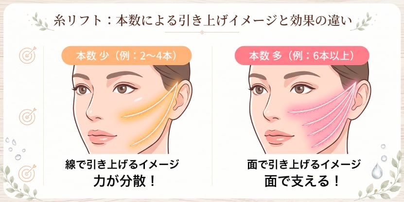 糸リフトによる引き上げのイメージ