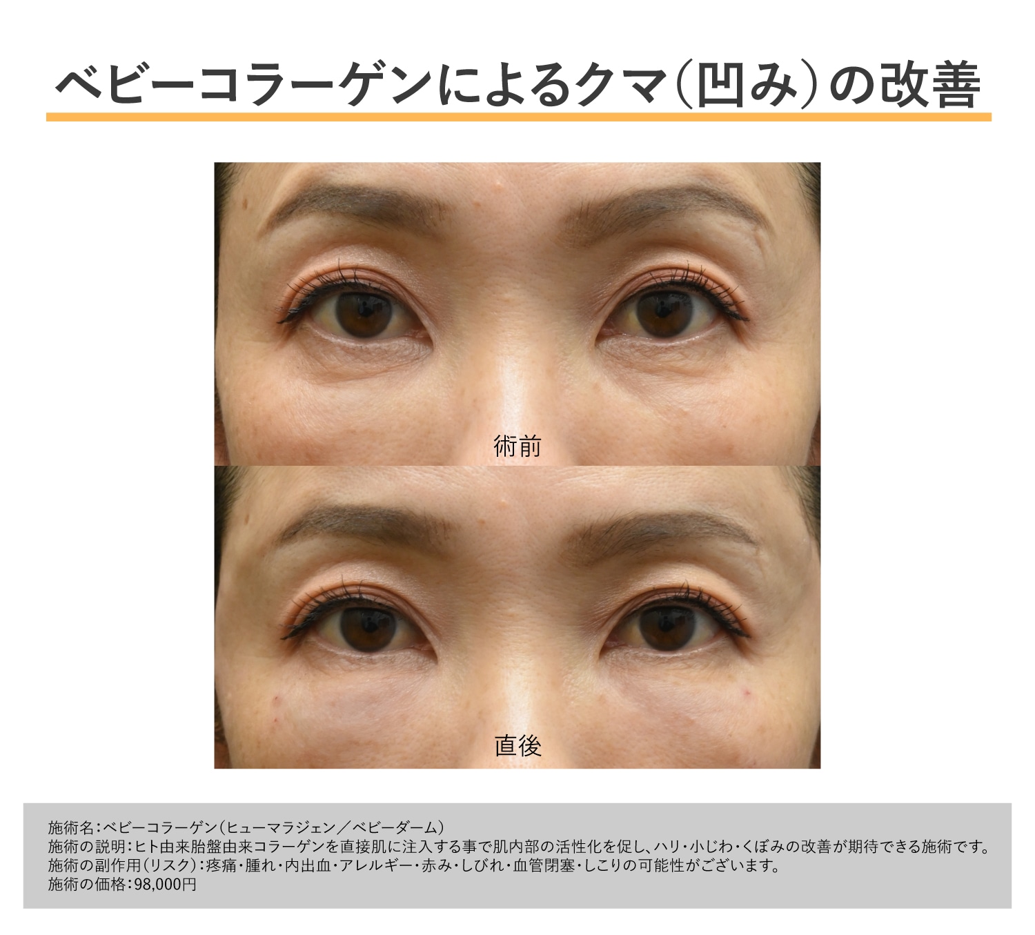 ベビーコラーゲンの症例