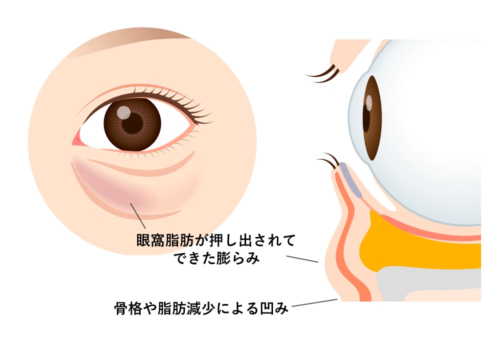 そもそもクマってなんでできるの？？