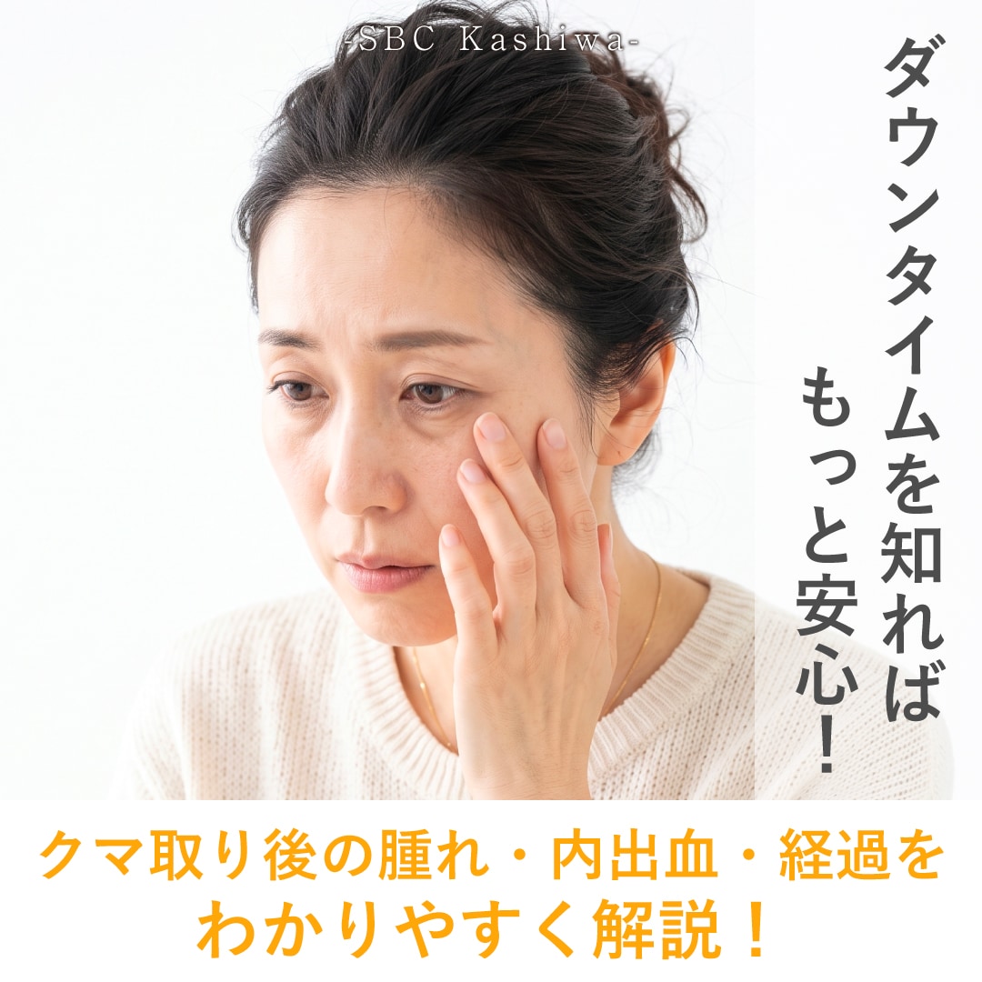 クマ取りのダウンタイムはどれくらい?腫れ・内出血の経過を解説!【柏院】
