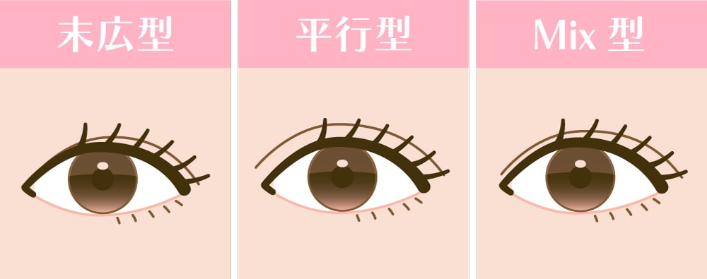 二重の種類