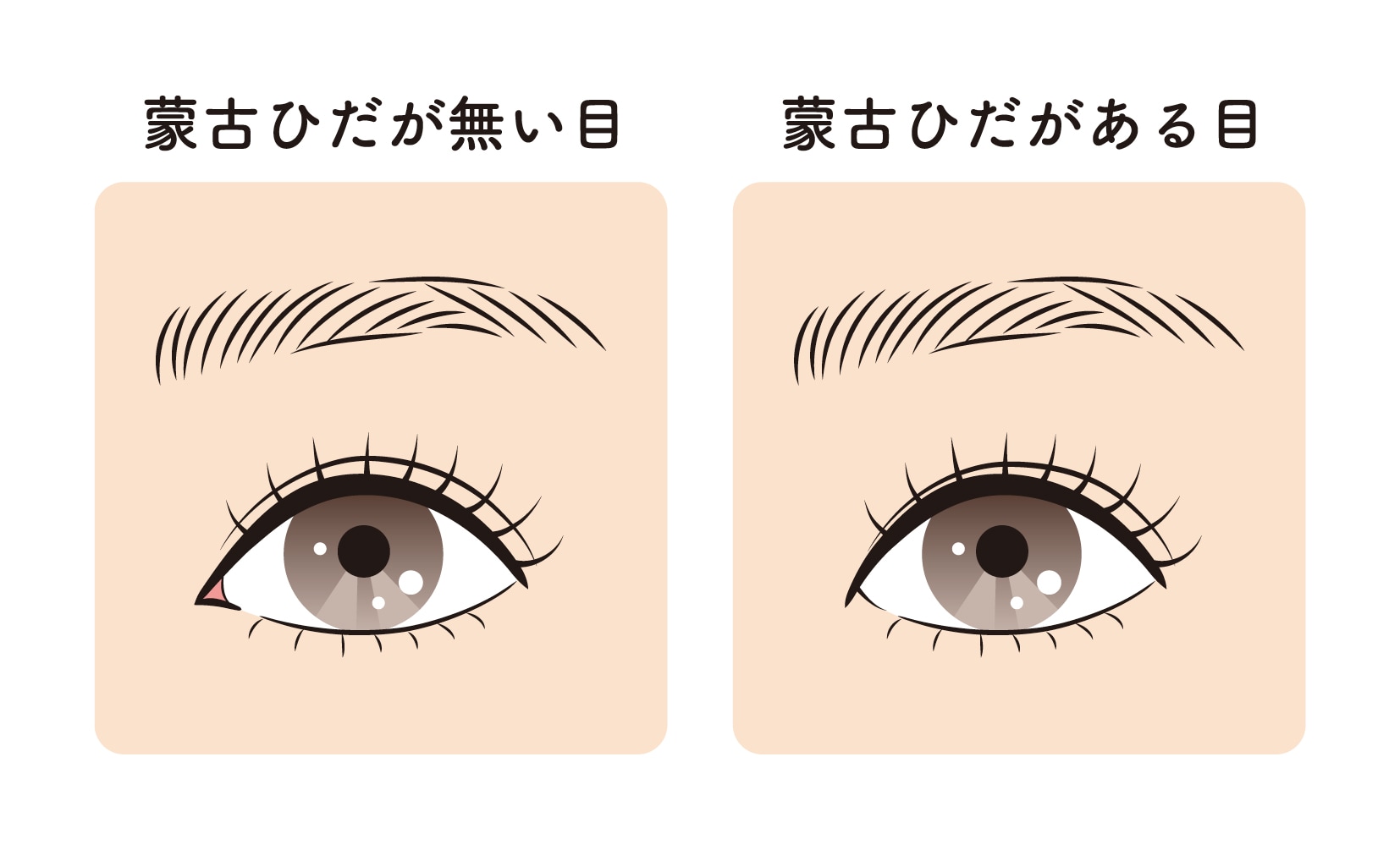 蒙古襞（もうこひだ）とは？