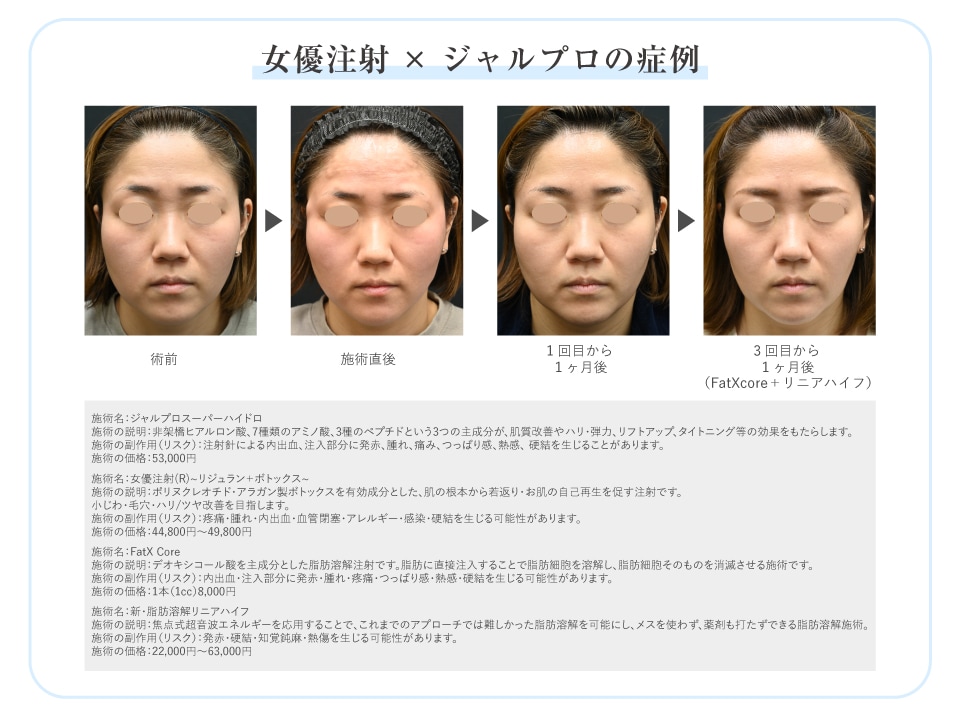 肌投資で変わる大人の自信肌