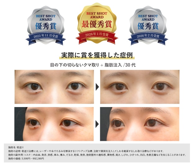 【確かな技術力】クマ取りの症例で「ベストショットアワード」を3回受賞