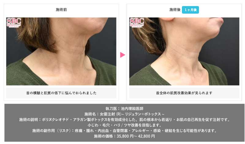 首