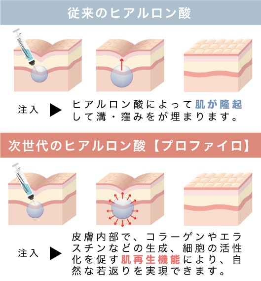 どのあたりが”次世代”なの？