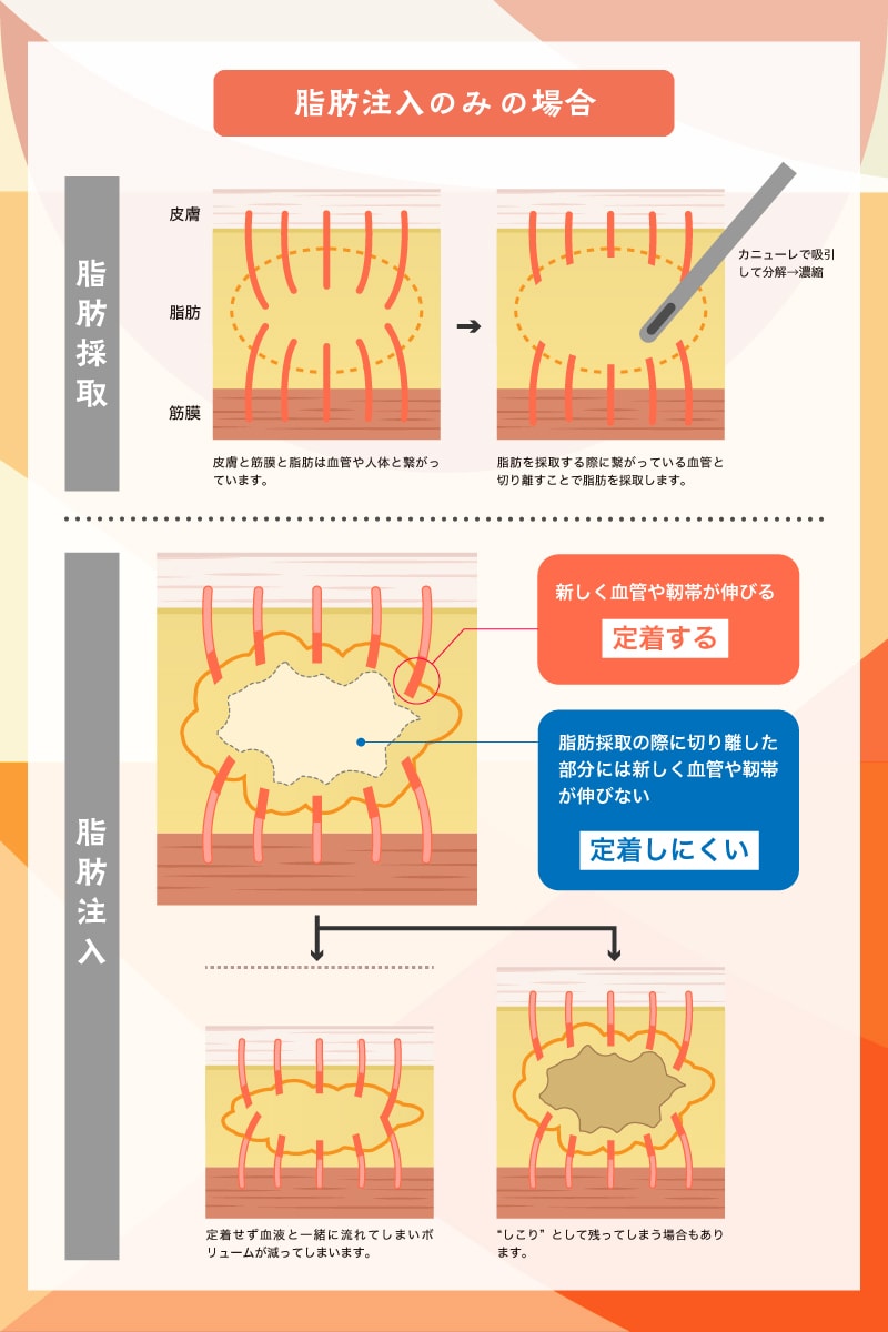 脂肪はなぜ全部定着しないの？