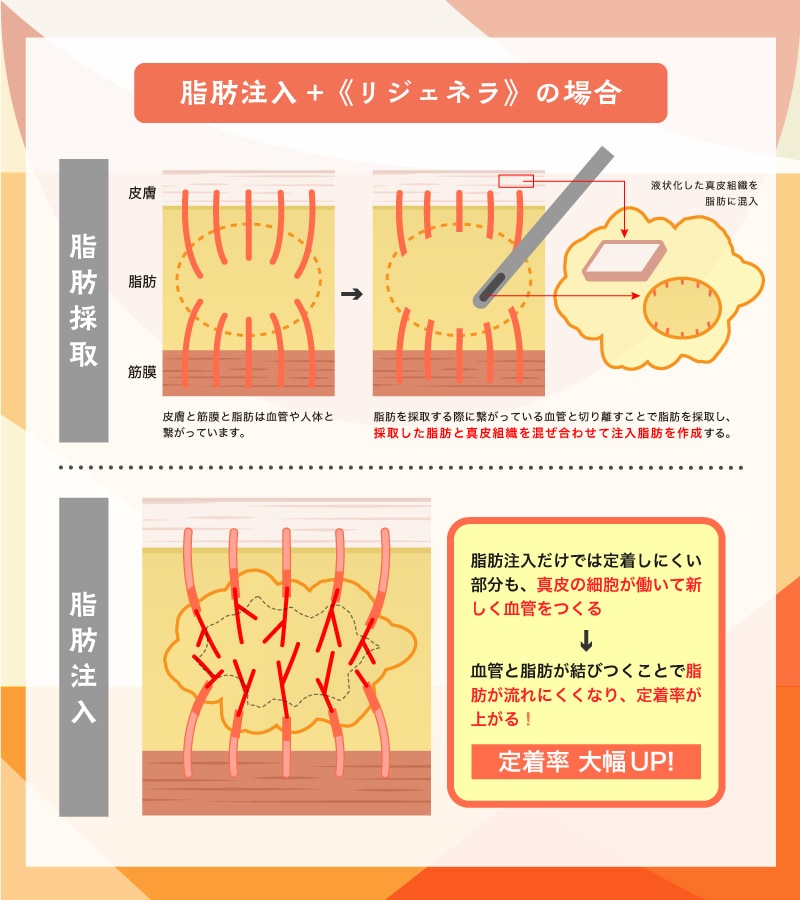 《リジェネラ》がもたらす効果