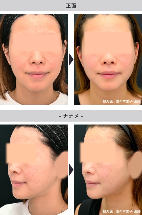 30代女性