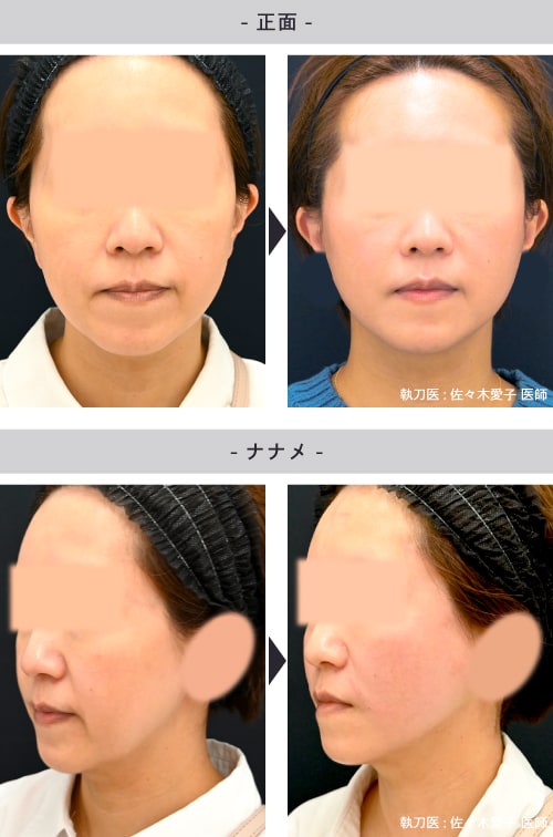 40代女性