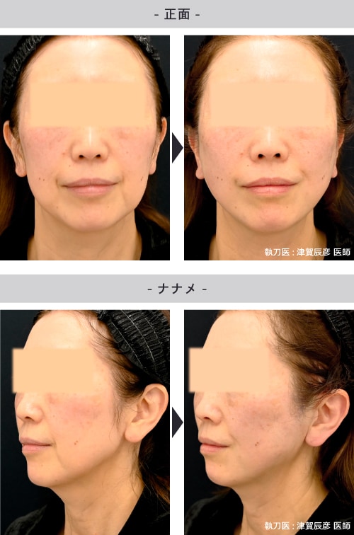 50代女性