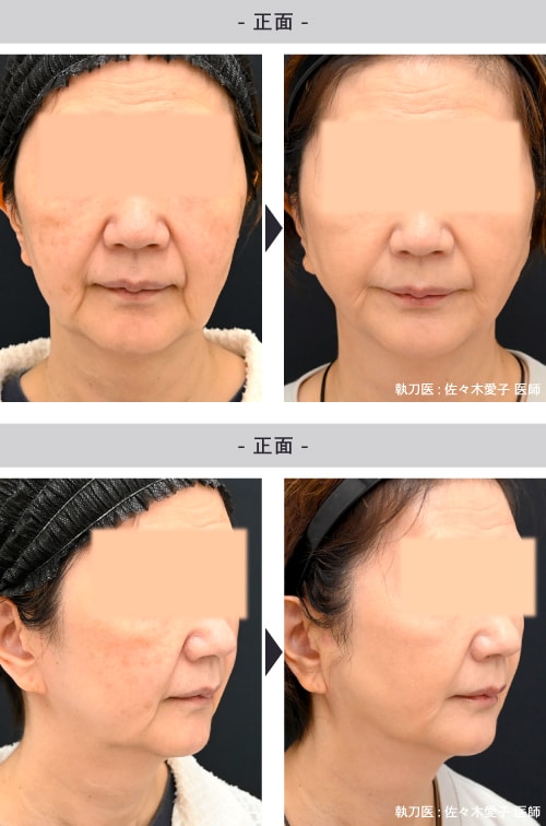 60代女性