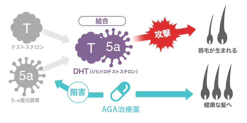 AGAの治療方法は、大きくわけて下記の3つです。