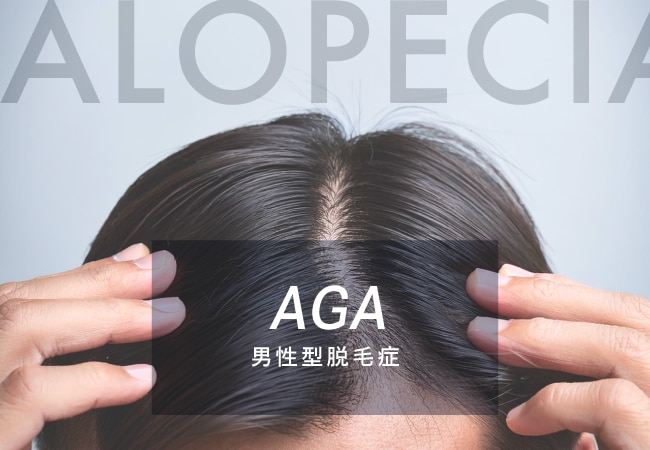 【AGA (男性型脱毛症）】治療なら、湘南美容クリニック川越院で！早めに適切な対策をおこなうことで悪化を遅らせることができます！