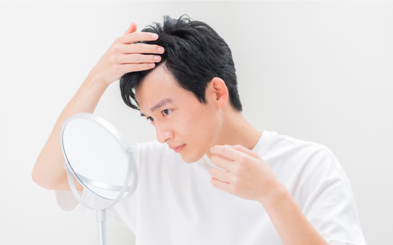 AGAとハゲは異なる？