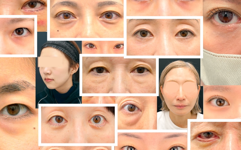 ①数字が語る信頼 | 累計若返り症例数18,000件以上の実績