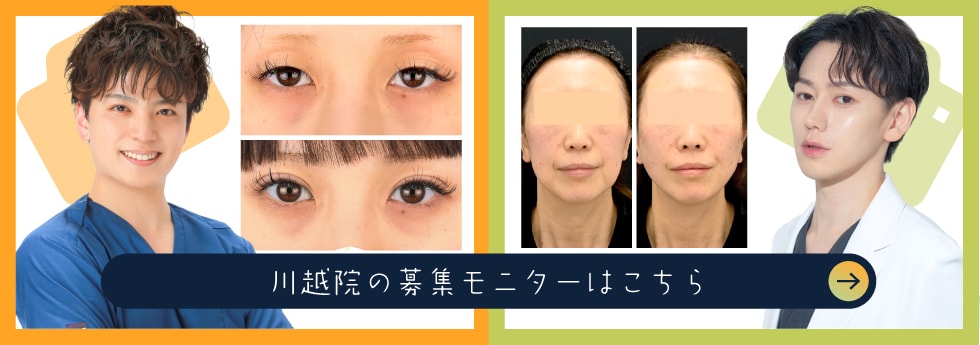 クマ改善や若返り・たるみ改善・二重など川越院のモニター募集一覧