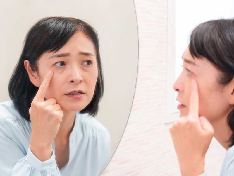 目の下のクマ・たるみについて