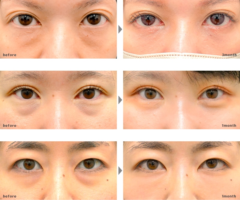 30代 | 裏ハムラ