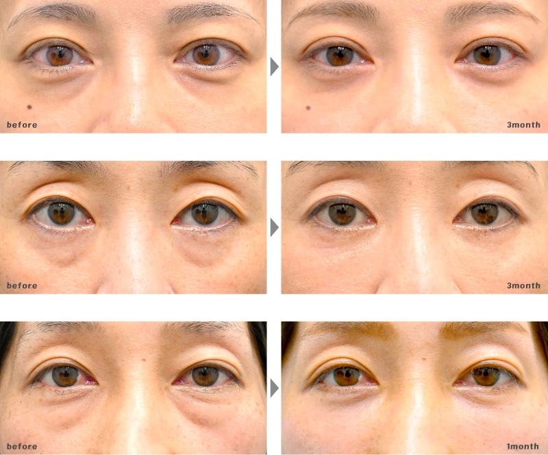 40代 | 裏ハムラ