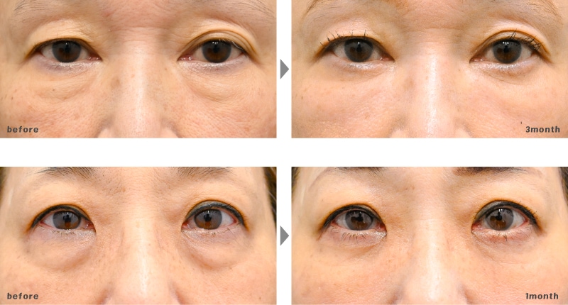 50~60代 | 裏ハムラ