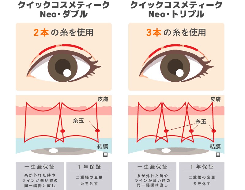 仕組みは共通で糸の数のみが違う