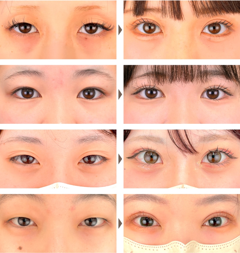 10代 | クイックコスメティークNeo・ダブル