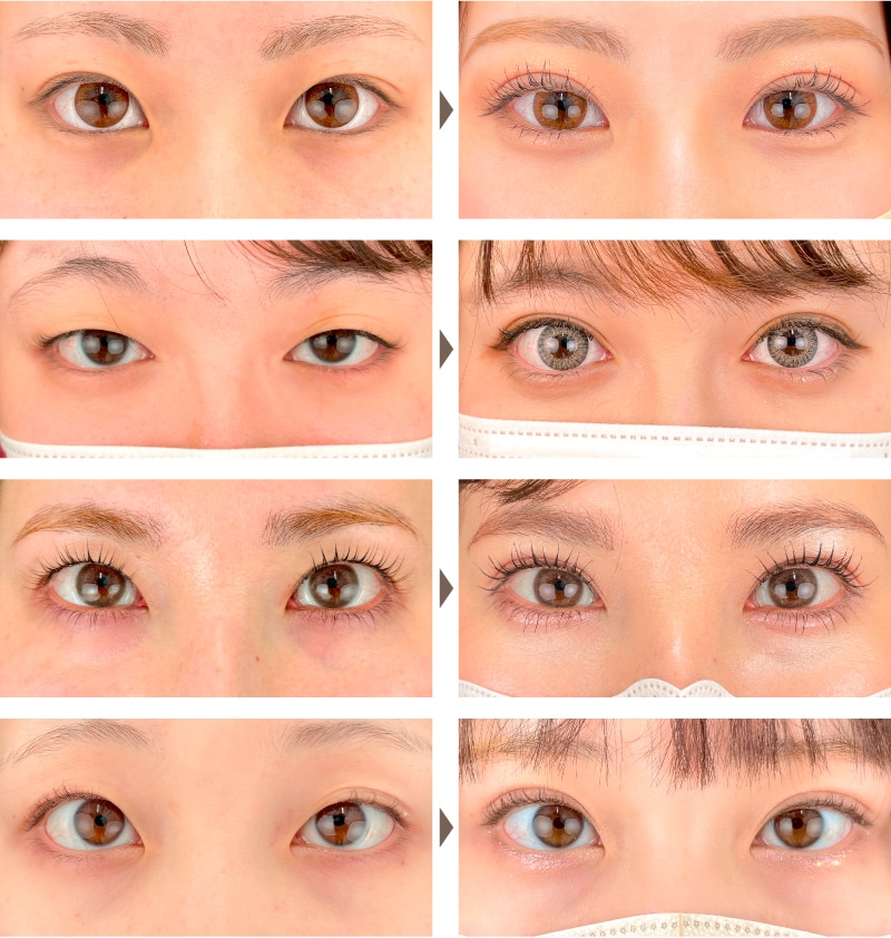 20代 | クイックコスメティークNeo・ダブル