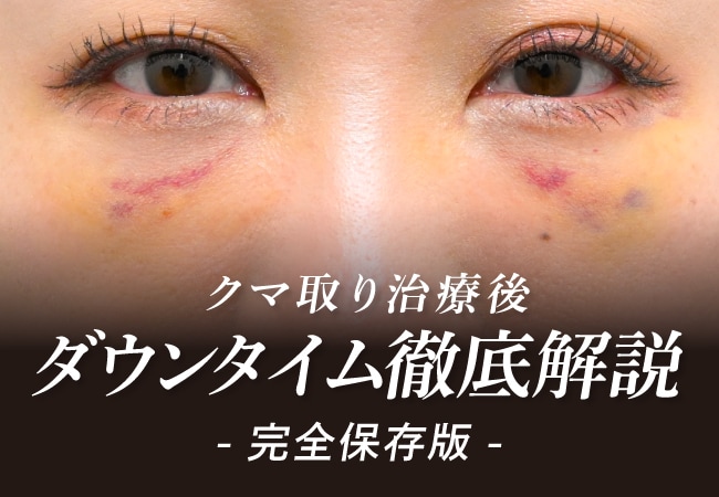 クマ取り治療ダウンタイムのリアル！実際の症状と早めに治すための秘訣を徹底解説します