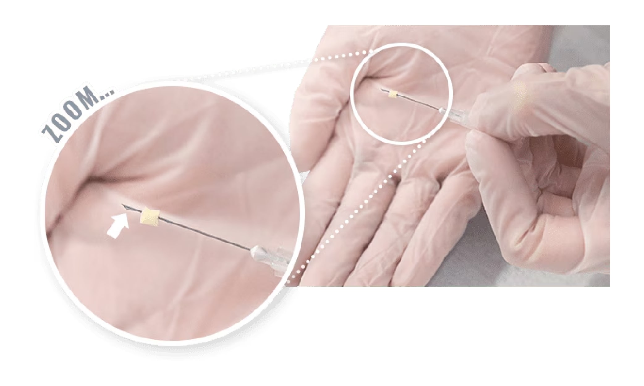 ハイフ×トキシルスレッド