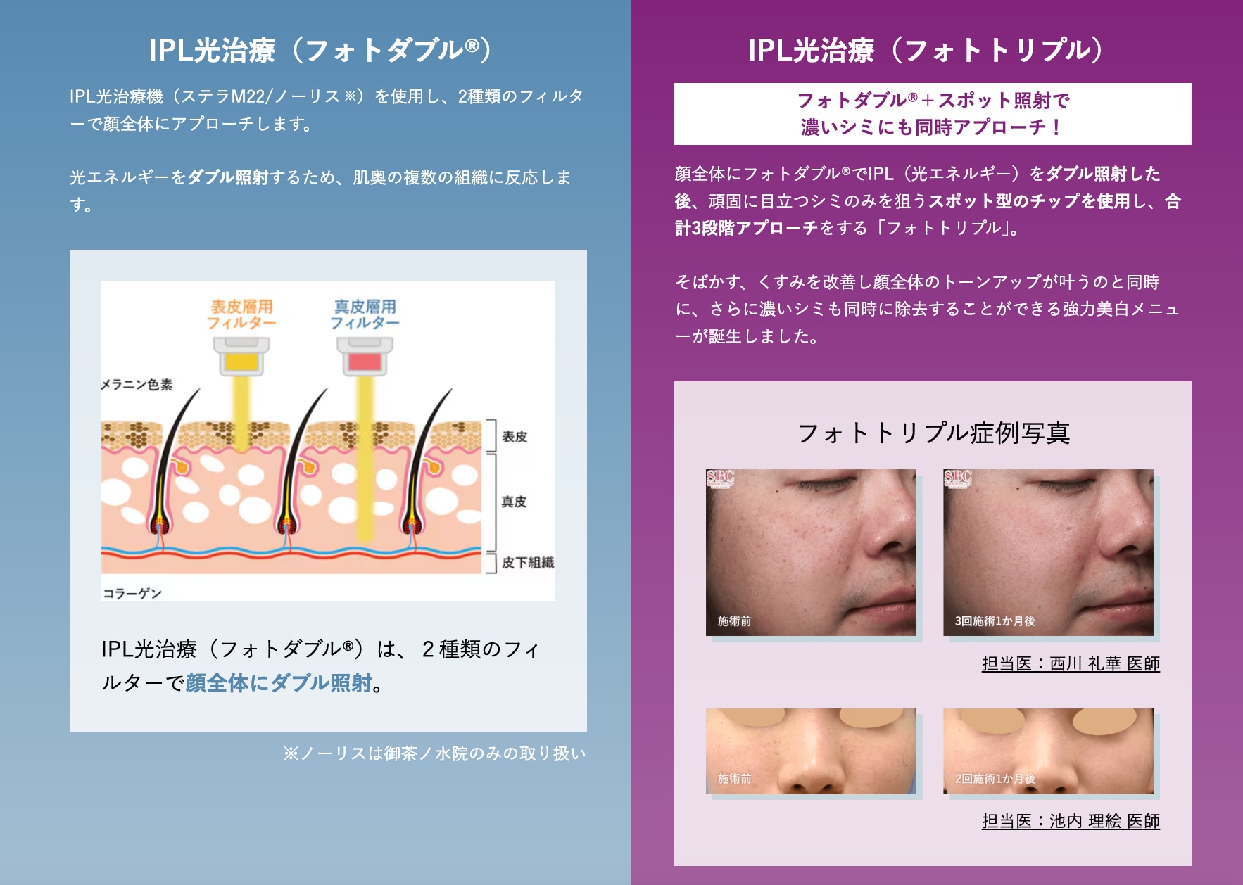 善は急げ！】川口で受けたいシミ取り施術とホームケアをご紹介 - 川口院