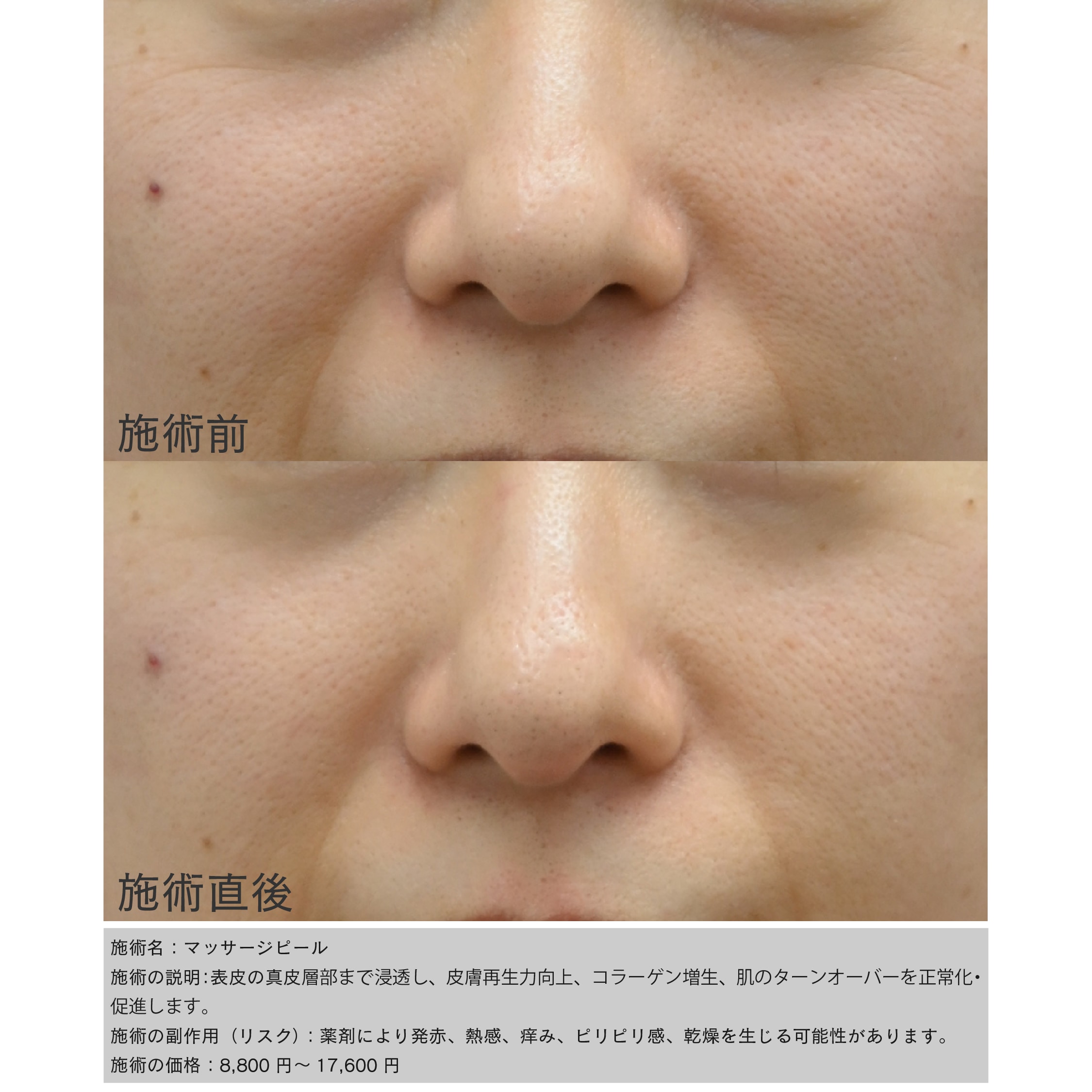 症例写真