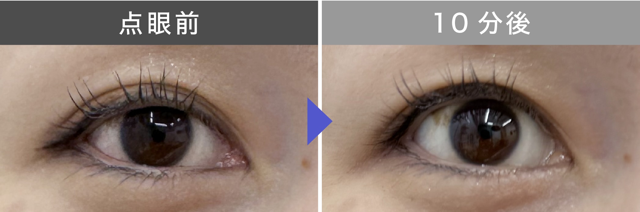 点眼10分後に効果が…！