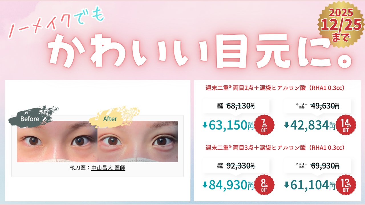 週末二重術＋涙袋ヒアルロン酸セット割♡