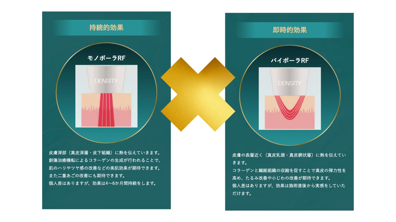 ここがすごい！