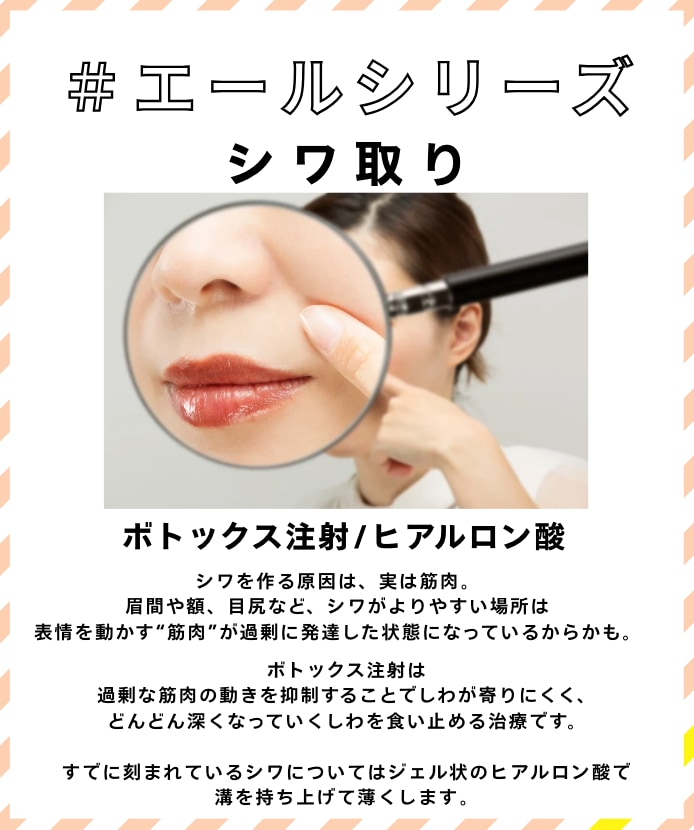 シワ取り