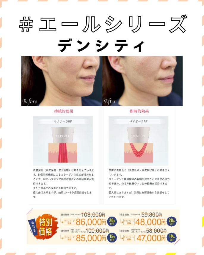 デンシティ