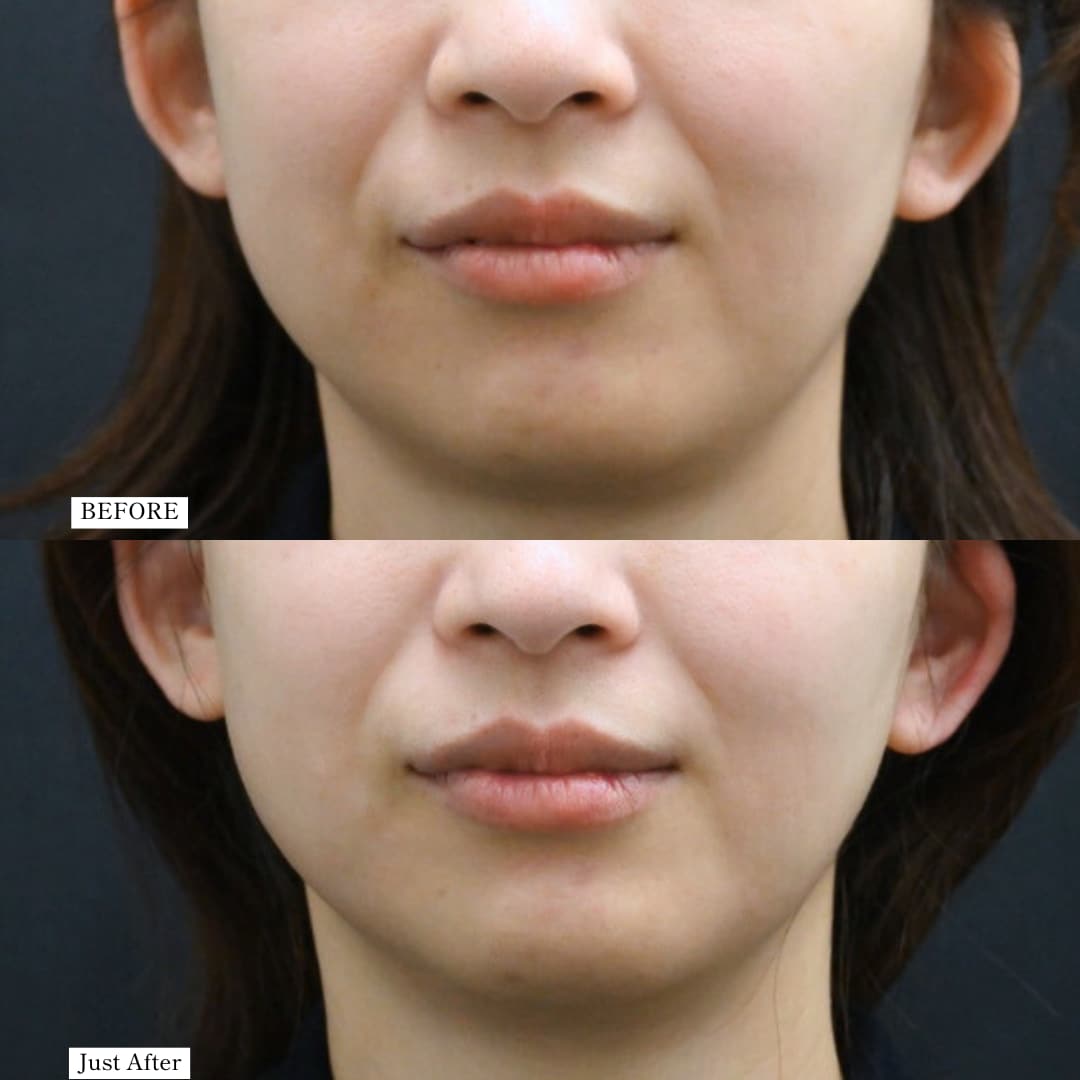 スタッフMさん、デンシティどうだった？