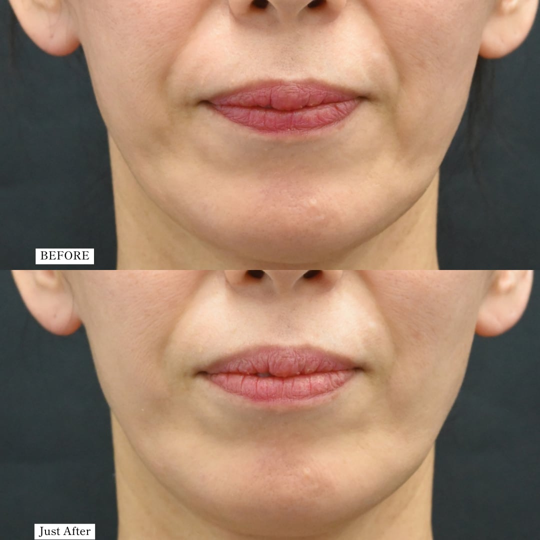 スタッフKさん、デンシティどうだった？