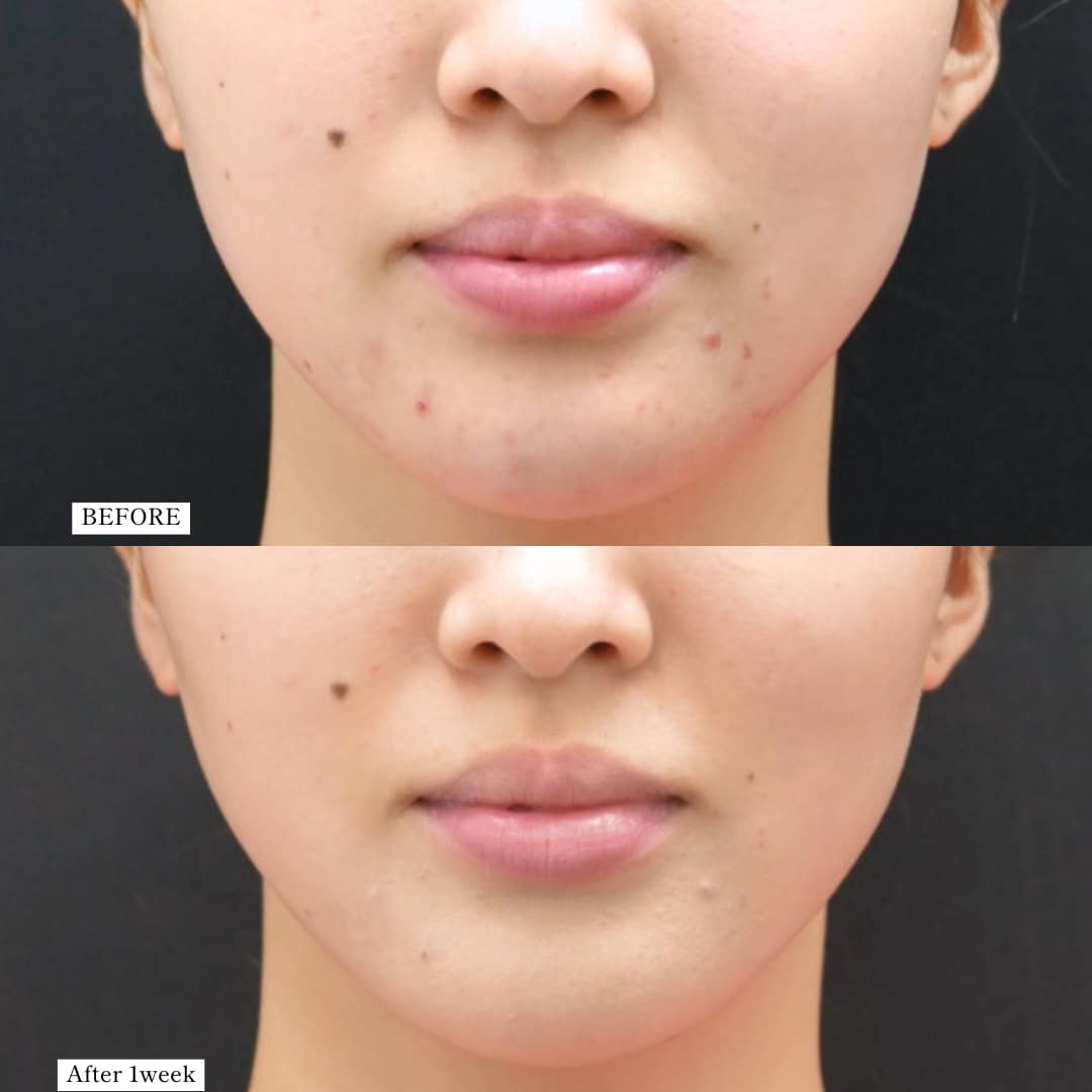 スタッフOさん、デンシティどうだった？