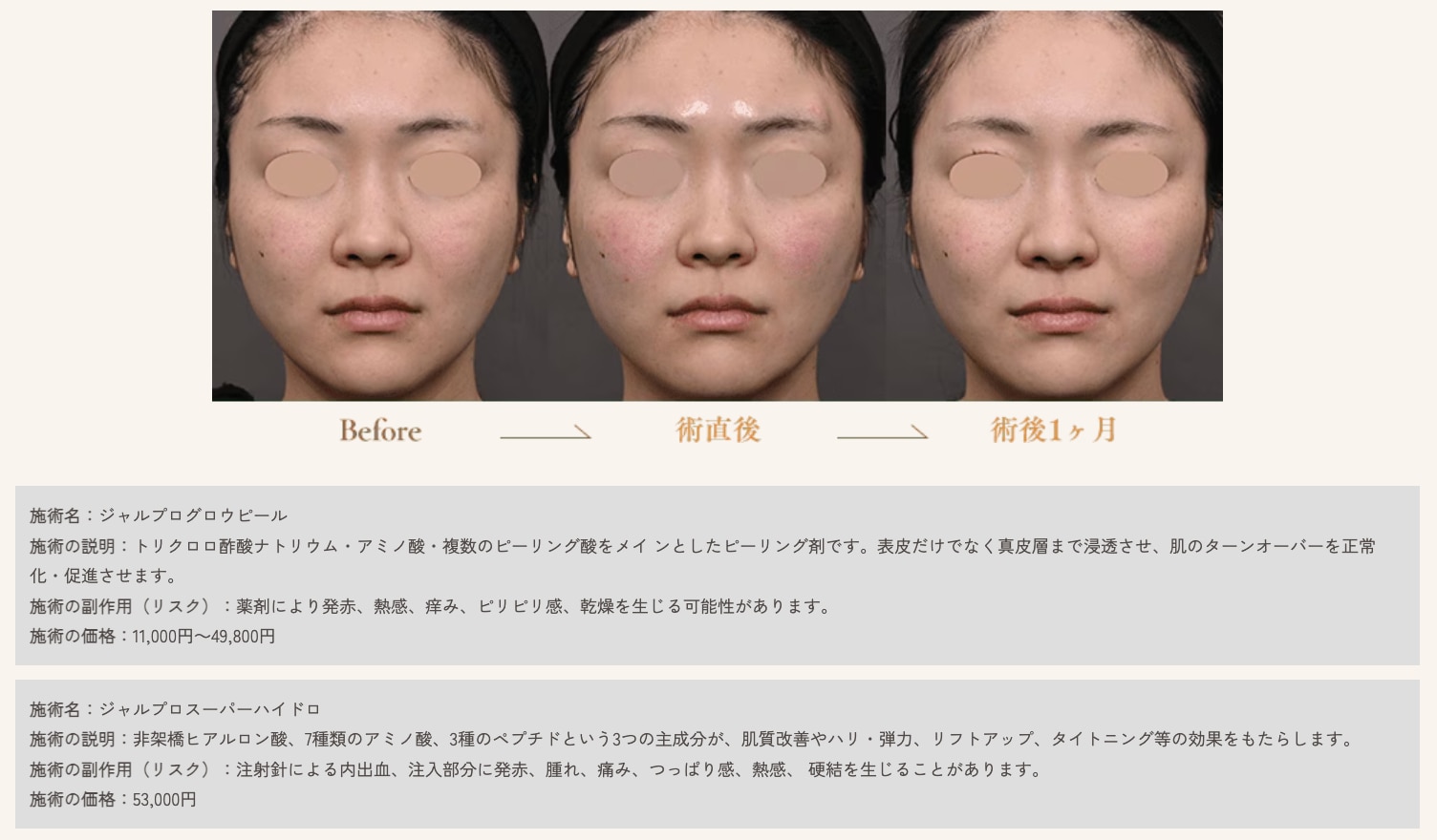症例写真