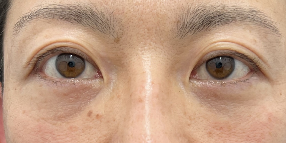 【佐藤広太郎】クマ取り