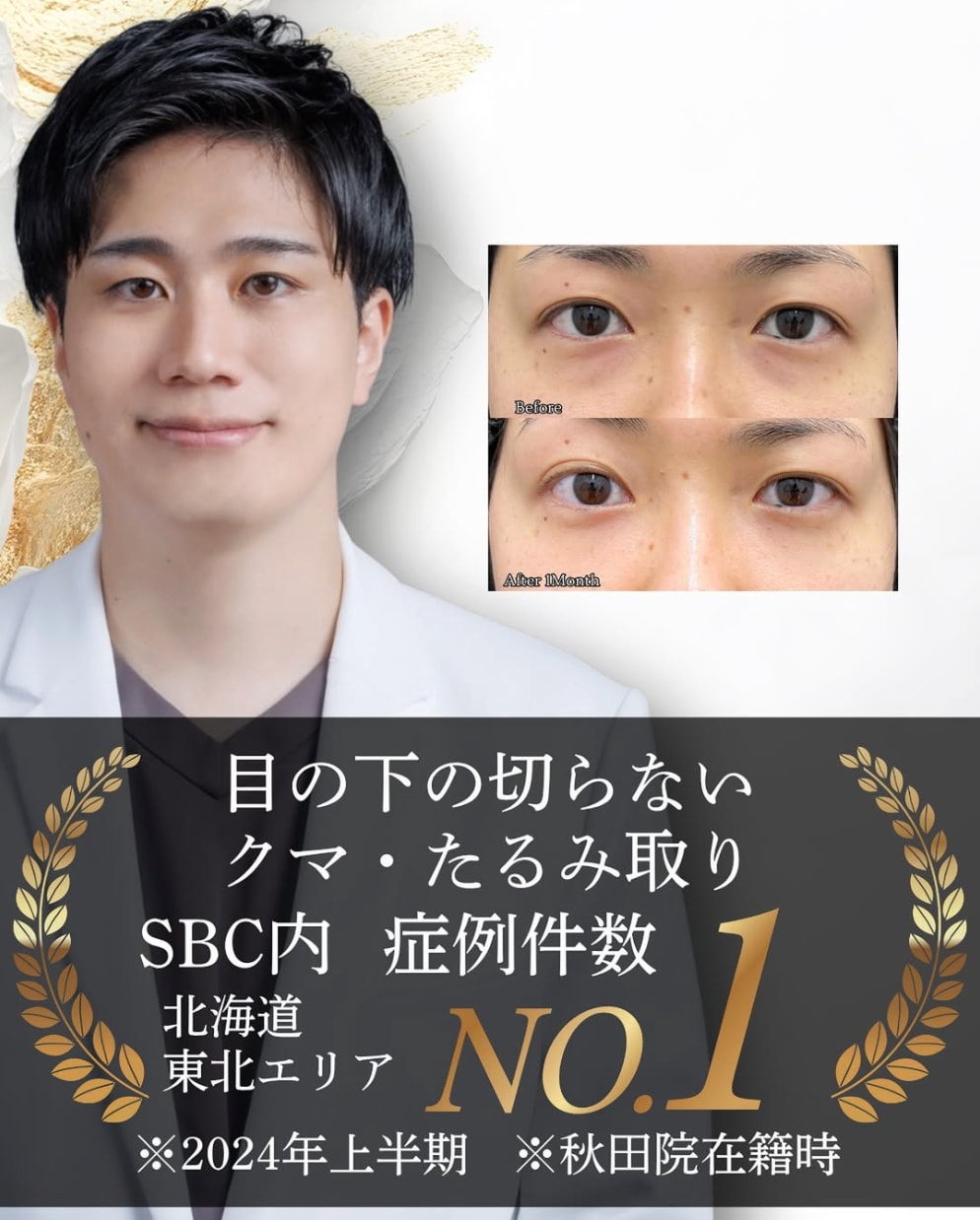 佐藤広太郎医師のクマ治療が刺さる理由