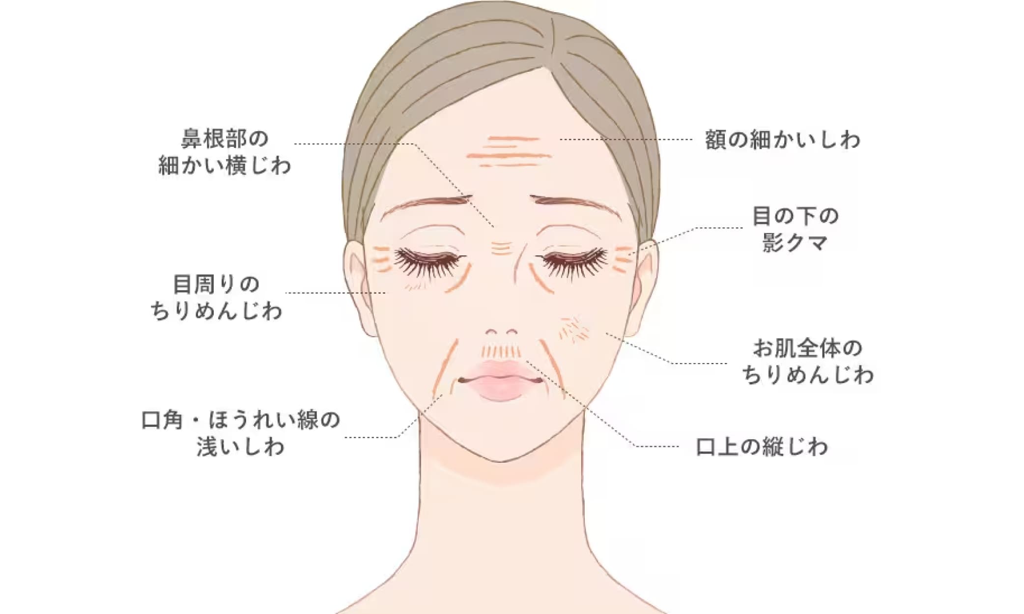 注入部位