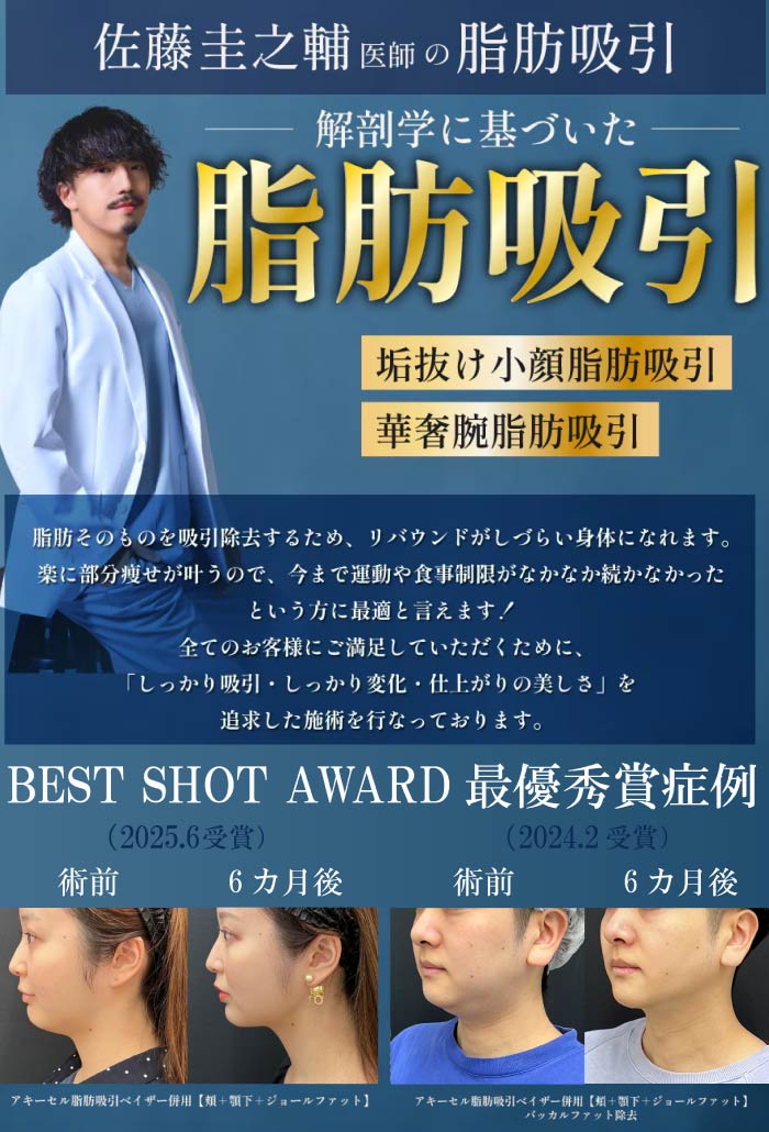 💖 【限定】佐藤圭之輔先生の脂肪吸引が半額に！