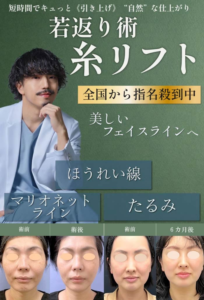 【耳鼻咽喉・頭頚部外科出身】指導医が認めたデザイン力【芸術的な糸リフト】で、もたつきを解消！