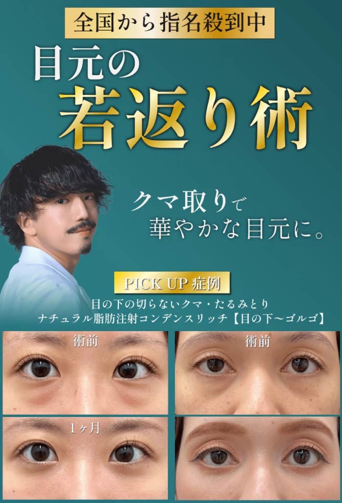 【耳鼻咽喉・頭頸部外科出身】オーダーメイドのクマ治療で圧倒的な若返りを実現いたします！